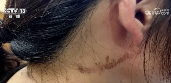 配资专家门户 近期“飞行的硫酸”活跃，遇到千万别拍！